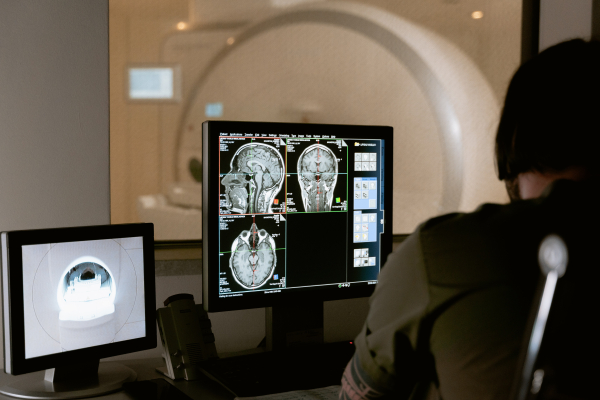 Déroulement MRI
