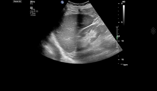Interprétation des images